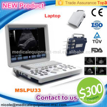 Die beliebteste tragbare preiswerteste B / W Ultraschallmaschine für die Schwangerschaft MSLPU33-I